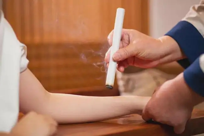 艾灸和拔罐的注意事項！